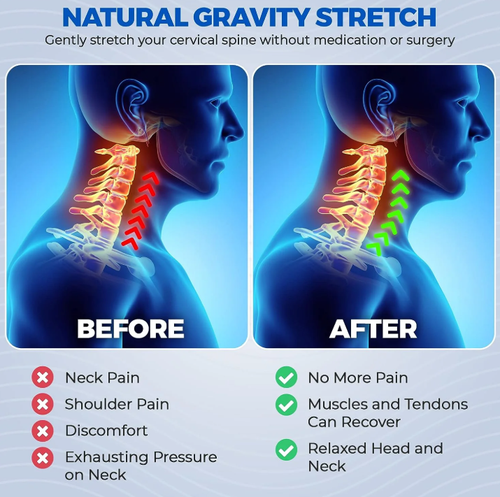 The Original Neck-Cloud™ - Instant Cervical Relief